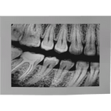 X-RAY TEETH PHOTO